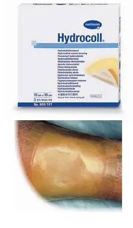 MEDICAZIONE IDROCOLLOIDALE HYDROCOLL ASSORBENTE 10X10CM 10 PEZZI